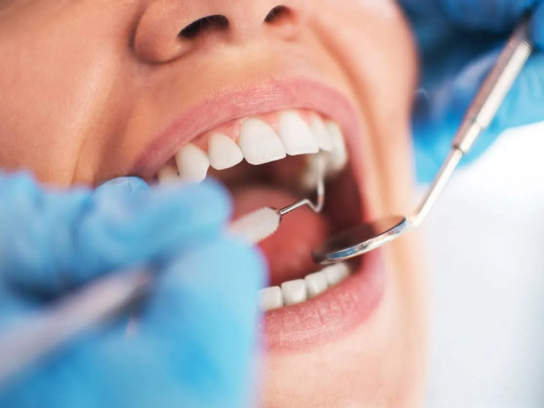 Dentysta kontroluje zęby pacjęta.