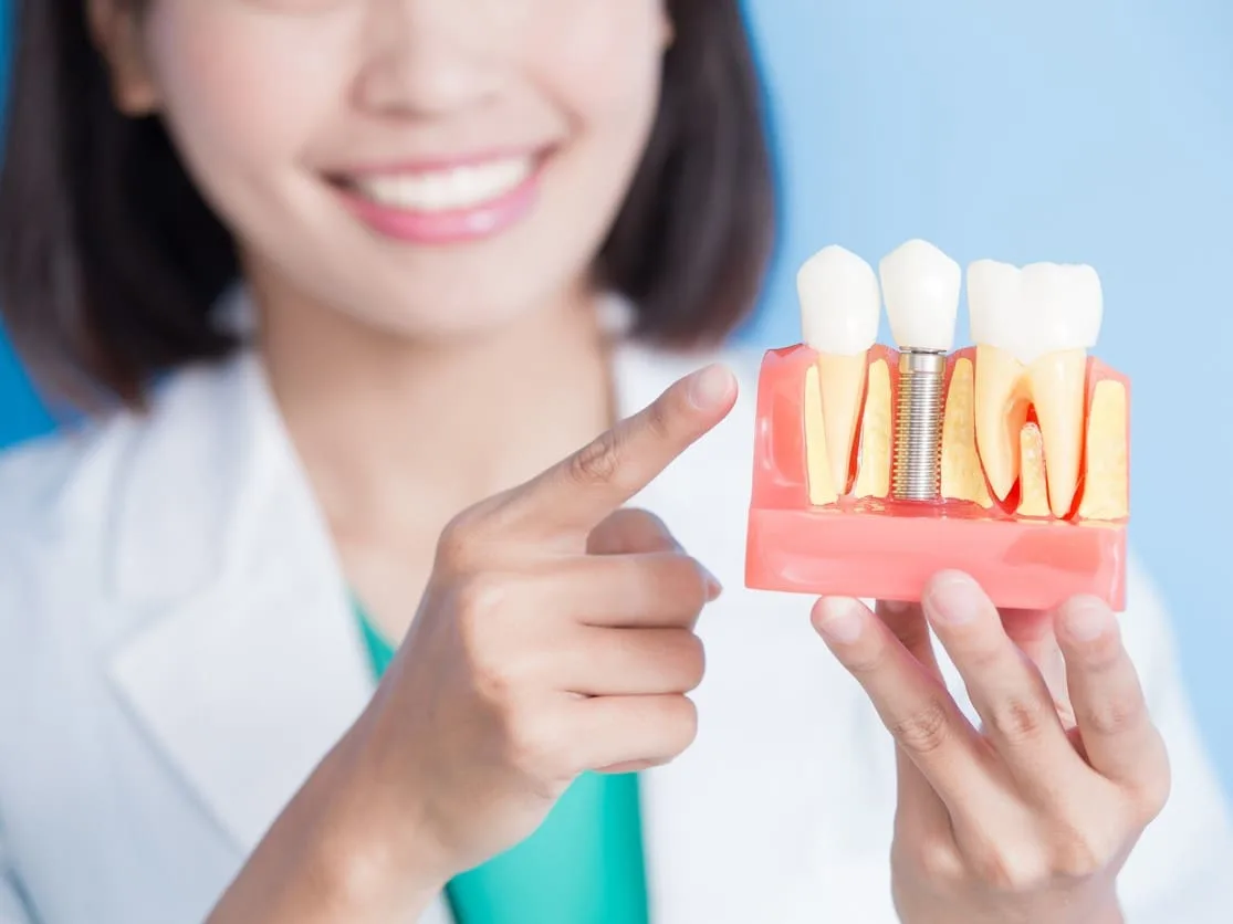 Dentysta pokazuje model kawałka szczęki z implantami zębów.